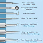 ultra fine blackhead remover tweezers set with precision tips for extracting nose blackhead and blemish popping