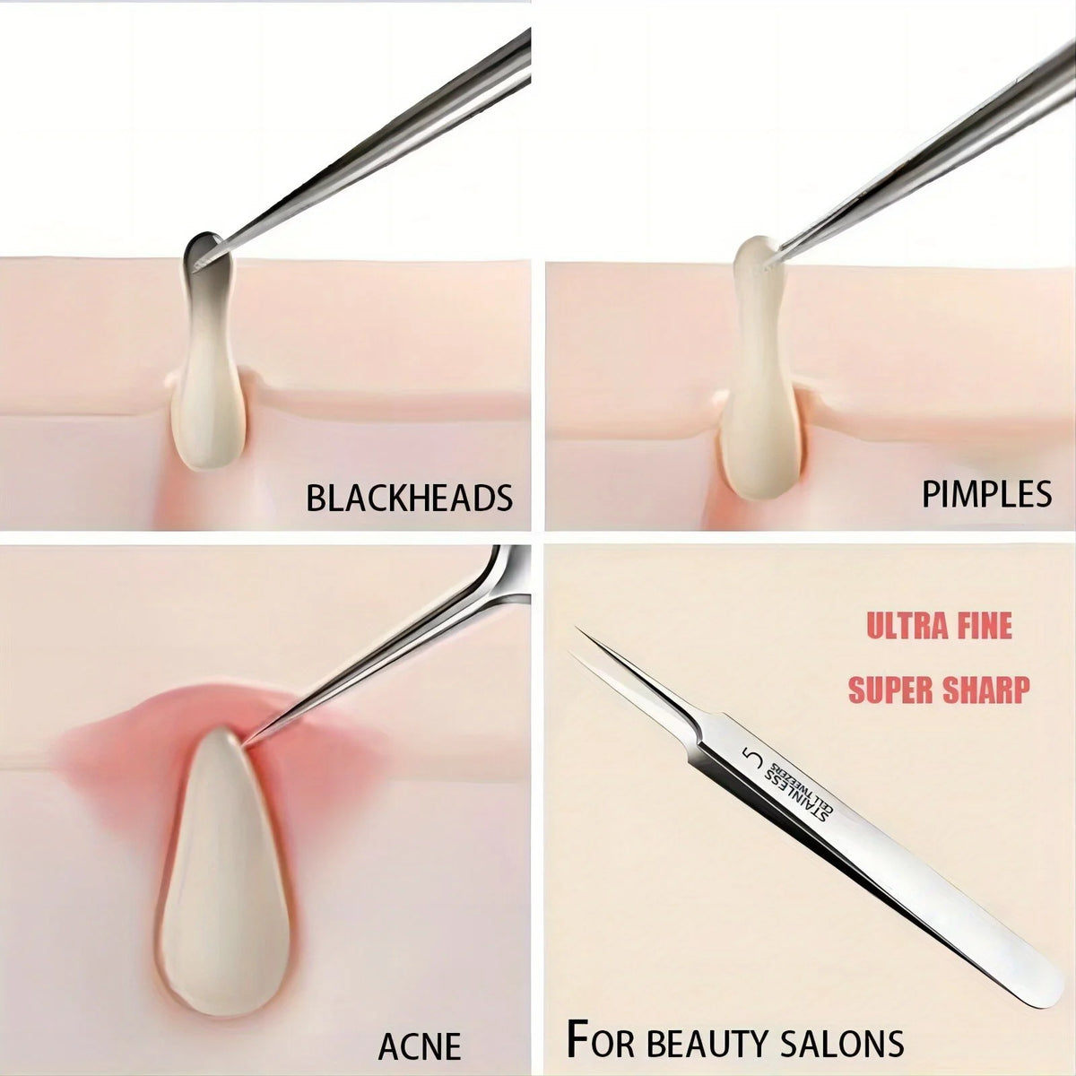 Blackhead tweezers durable stainless steel facial skin tool for hygienic pore cleaning.