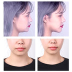 face lifting tape before and after side profile view for neck tightening and double chin reduction