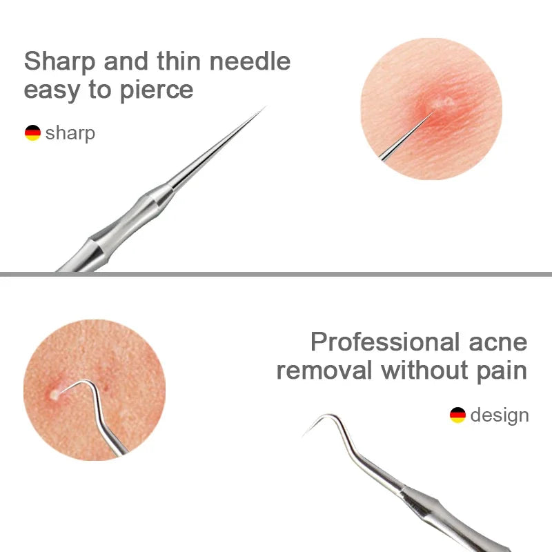 German Acne Blackhead Removal Needle hygienic extraction comparison against finger squeezing to prevent scarring and infection