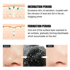 Nose Blackhead Remover Mask Strips multiple black patch set for regular deep pore cleansing