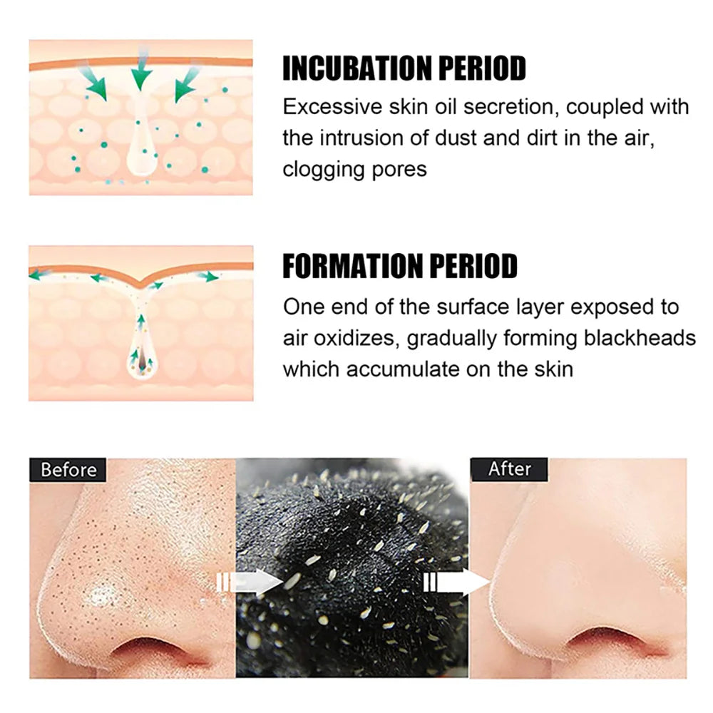 Nose Blackhead Remover Mask Strips multiple black patch set for regular deep pore cleansing