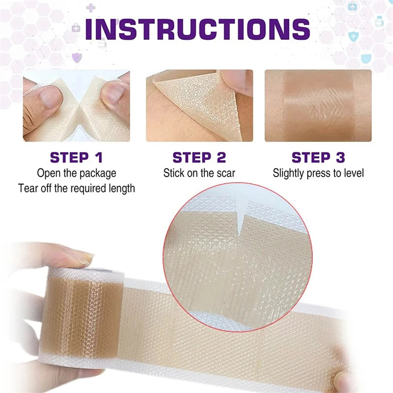 silicone scar tape applied on arm skin for discreet wound care and scar healing protection