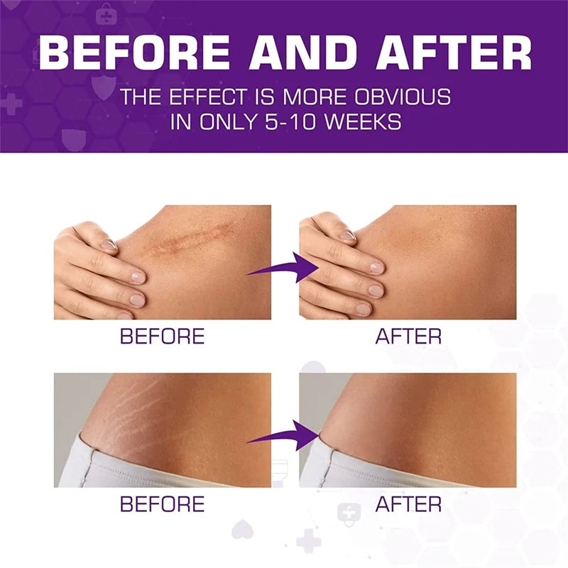 how to apply silicone scar tape step by step guide for effective scar treatment and skin healing
