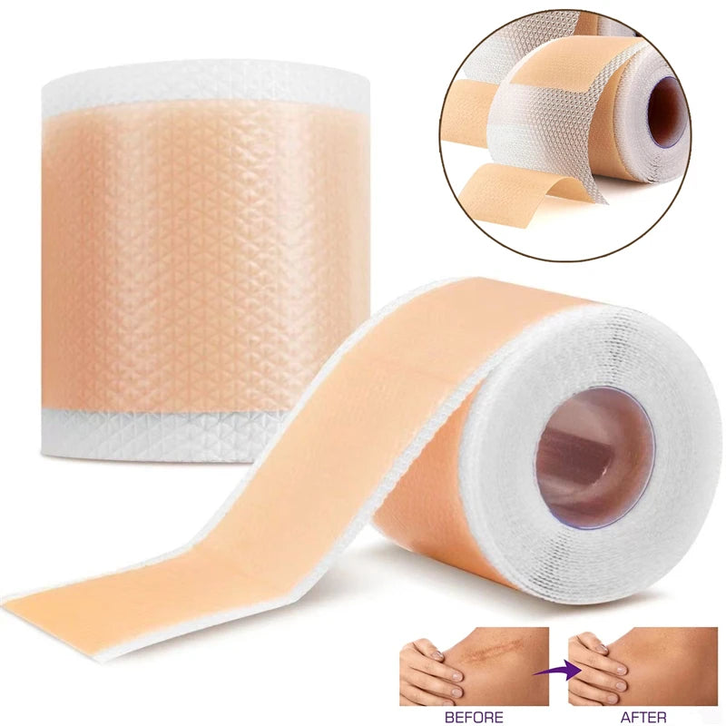 silicone scar tape roll unrolled showing breathable skin tone adhesive for scar reduction