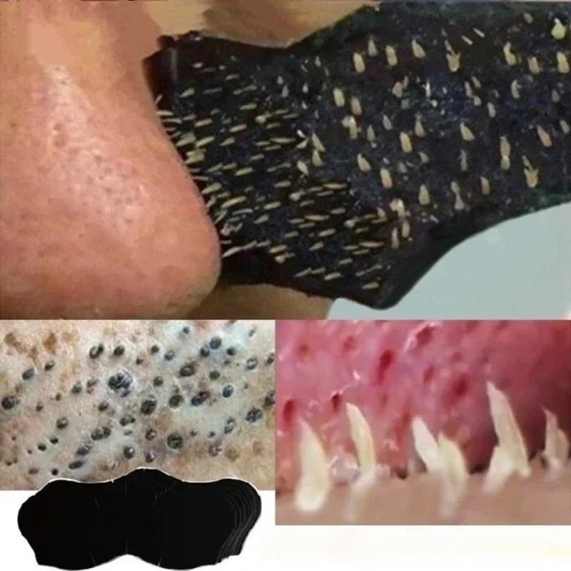 Unisex Blackhead Remove Mask Nasal Strips close-up dirt extraction view for clearing congested nose pores Main image